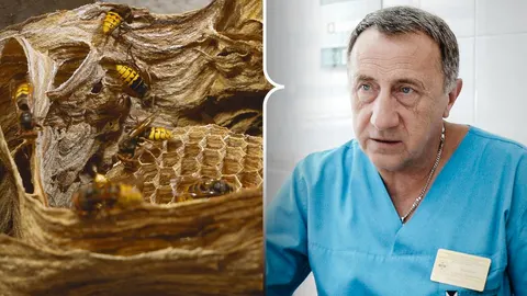 Укус шершня: що робити та як захиститися — поради лікаря